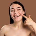 How to Banish Acne: Step-by-Step Skincare Guide