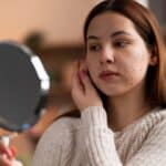 Stress-Related Acne Breakouts: Prevention Tips